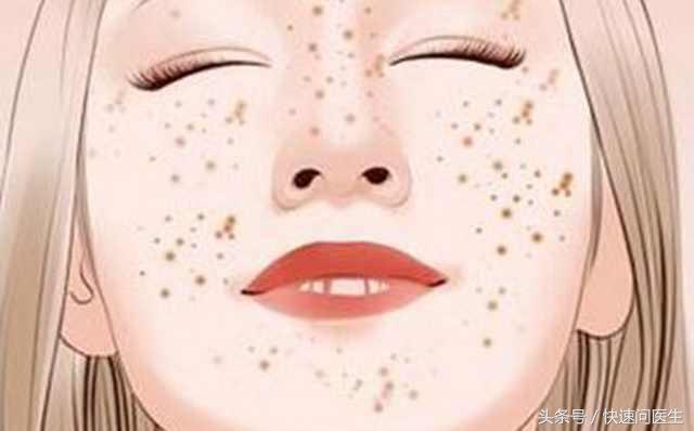 色素沉着淡斑内调方法,色素色斑怎么祛除最有效