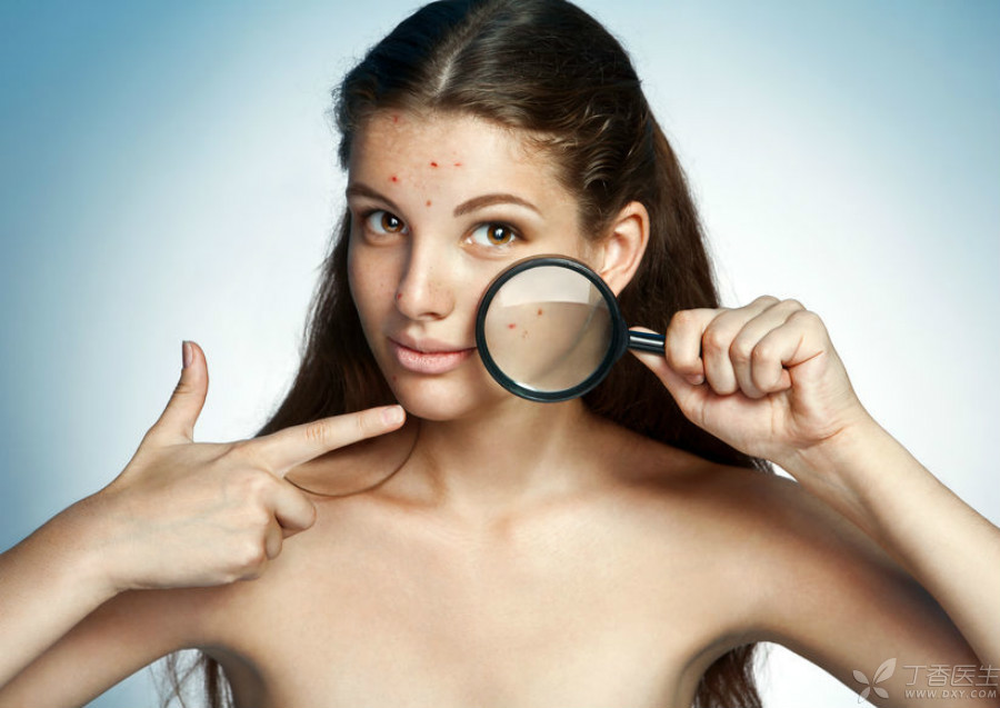护肤品过敏的痘痘是什么样的,护肤品用多了皮肤过敏