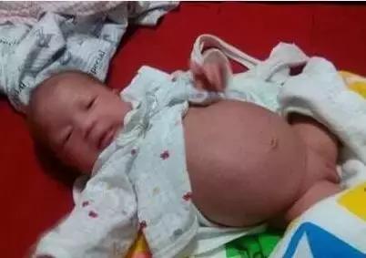 婴儿七八天没有大便医生说正常,宝宝5天没拉大便需要做什么检查