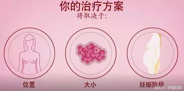妊娠期乳腺癌最佳治疗方法,妊娠期乳腺癌能治愈吗