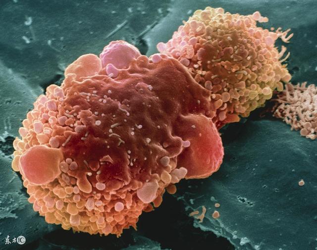 肺癌晚期食欲不振可以吃什么药,肺癌晚期食欲差能吃宜利治吗