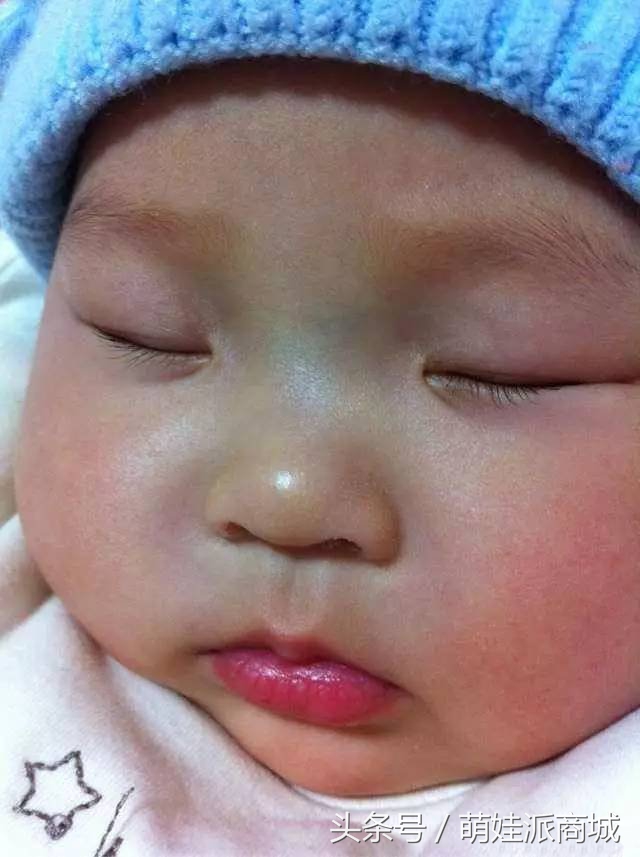 6岁女孩鼻梁有青筋怎么回事,7岁男孩鼻梁有青筋怎么回事