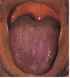 老中医看一眼就知道男子有病,老中医是如何看出某人有肛裂的