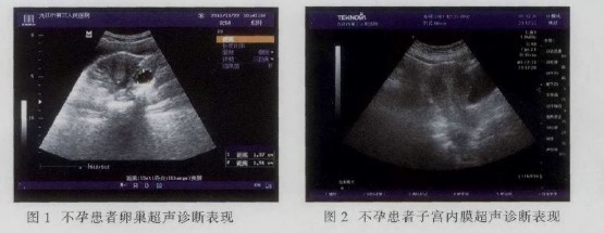测试排卵最准确的方法,测试排卵的正确方法