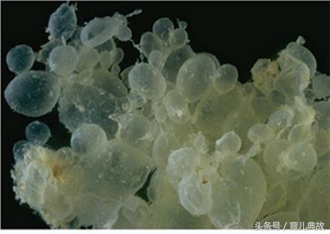 怀孕五月却检查出葡萄胎,这种心痛有谁能懂?