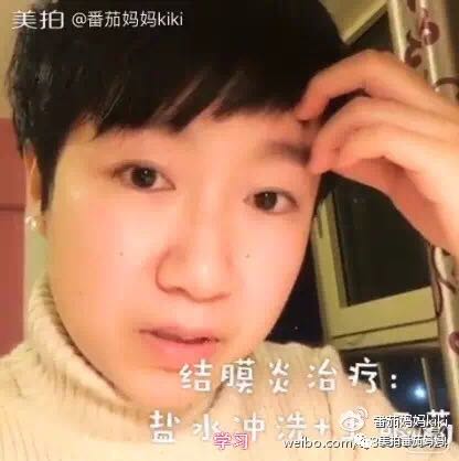 宝宝眼睛都是眼屎粘住了,宝宝眼睛被黄色眼屎糊住