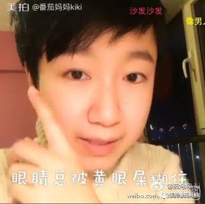 宝宝眼睛都是眼屎粘住了,宝宝眼睛被黄色眼屎糊住