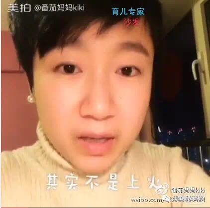 宝宝眼睛都是眼屎粘住了,宝宝眼睛被黄色眼屎糊住