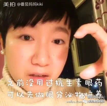 宝宝眼睛都是眼屎粘住了,宝宝眼睛被黄色眼屎糊住