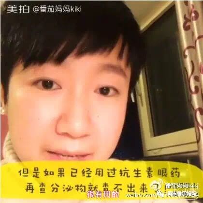 宝宝眼睛都是眼屎粘住了,宝宝眼睛被黄色眼屎糊住