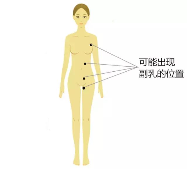 腋下长副乳该用什么药消除,腋下长有副乳怎么按摩去除