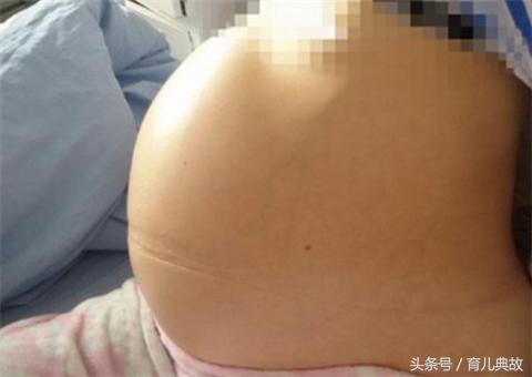 怀孕五月却检查出葡萄胎,这种心痛有谁能懂?