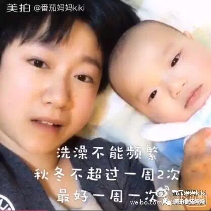 幼儿头垢和湿疹结痂的区别,湿疹洗澡用什么清洗