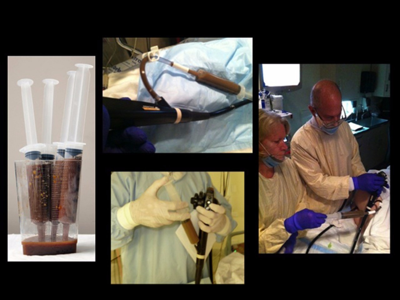 你狠心冲掉的便便，正成为许多肠胃病人的救星