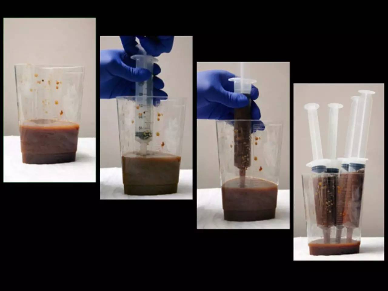 你狠心冲掉的便便，正成为许多肠胃病人的救星