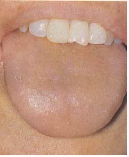 老中医看一眼就知道男子有病,老中医是如何看出某人有肛裂的