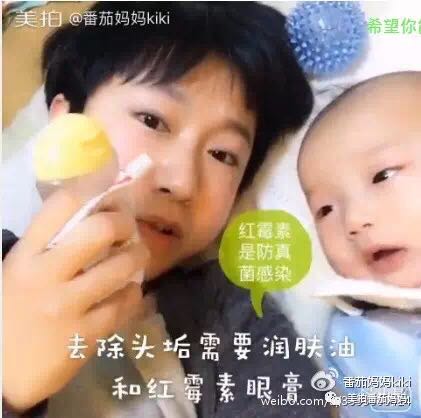 幼儿头垢和湿疹结痂的区别,湿疹洗澡用什么清洗