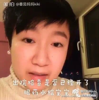 宝宝眼睛都是眼屎粘住了,宝宝眼睛被黄色眼屎糊住