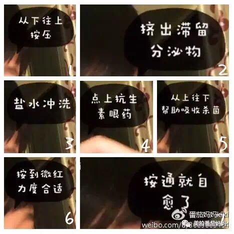 宝宝眼睛都是眼屎粘住了,宝宝眼睛被黄色眼屎糊住