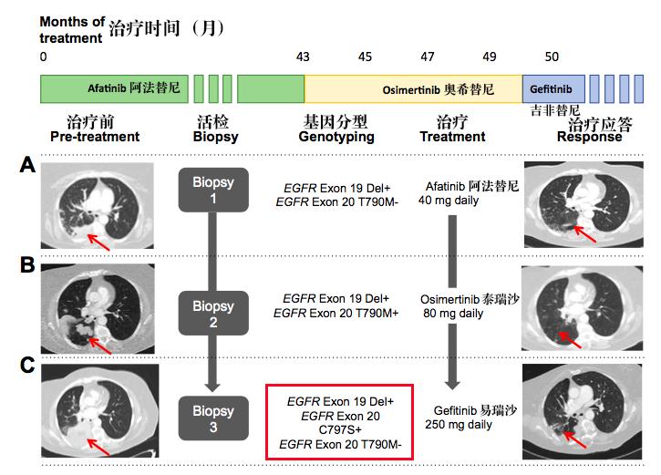 奥希替尼耐药没有t790突变,奥希替尼9291有效吗
