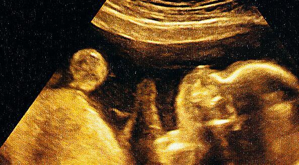 怀孕5个月胎动都是在下腹处,怀孕5个月胎心正常感觉不到胎动