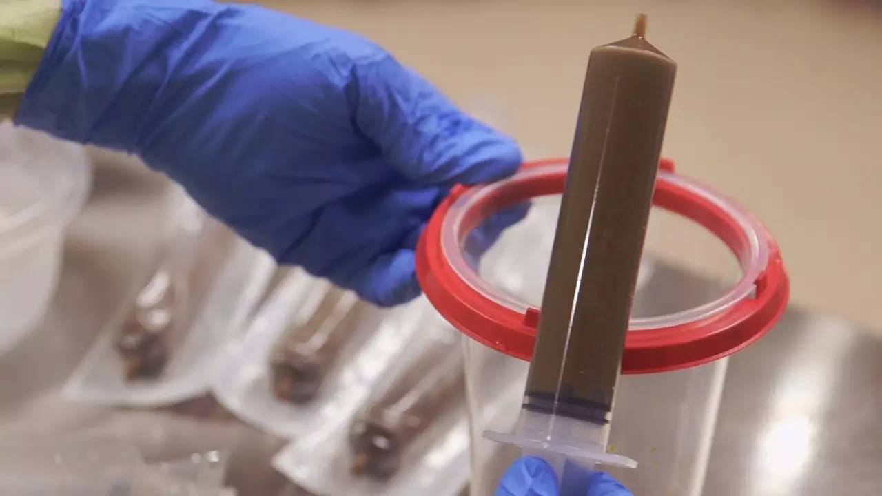 你狠心冲掉的便便，正成为许多肠胃病人的救星