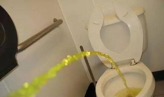 不同颜色的尿液所代表的疾病汇总,尿液颜色对照7种身体状况