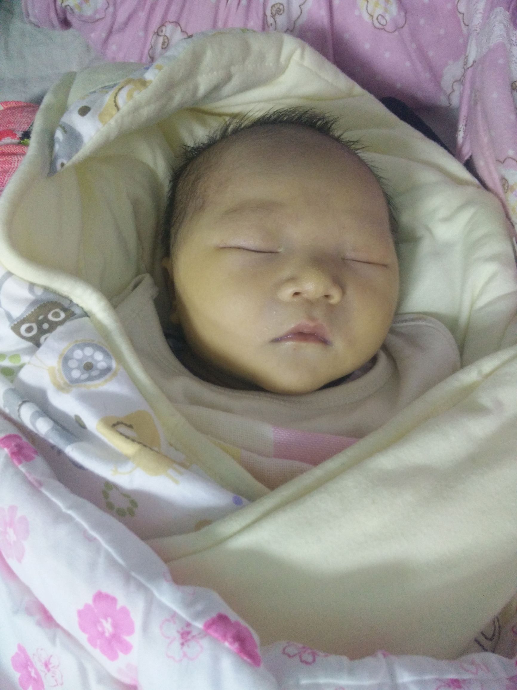 宝宝湿疹妈妈很着急,宝宝湿疹的正确防治方法