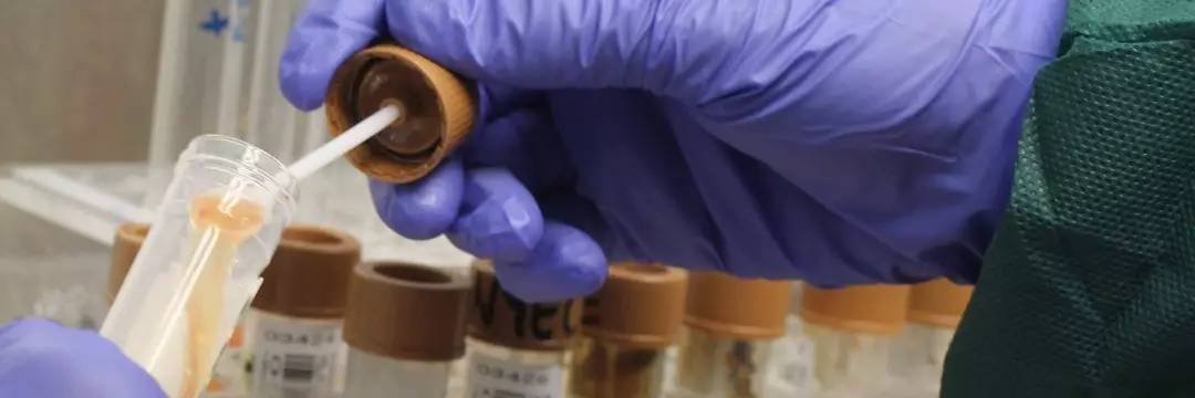 你狠心冲掉的便便，正成为许多肠胃病人的救星