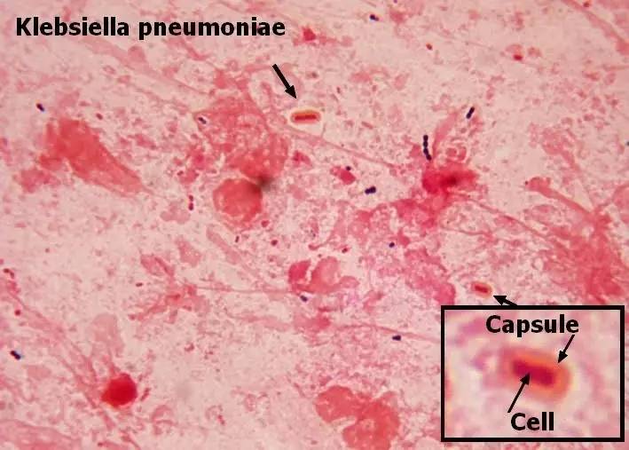你狠心冲掉的便便，正成为许多肠胃病人的救星