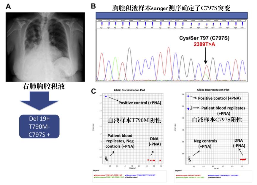 奥希替尼耐药没有t790突变,奥希替尼9291有效吗