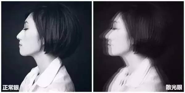 儿童散光会引起哪些问题,散光未来可不可能治好