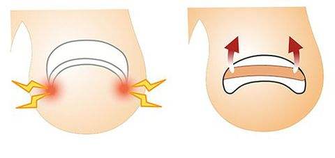 指甲往肉里长该怎么办?一定要试试这几招!