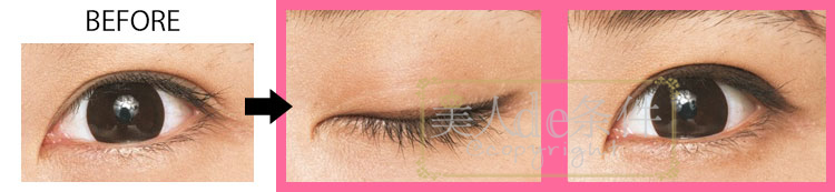 内双肿眼泡怎么不贴双眼皮画眼妆,一个单眼皮一个双眼皮怎么化眼妆