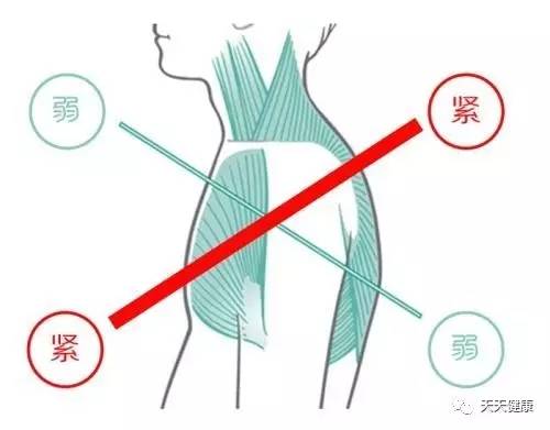 怎么姿势能预防颈椎病,预防颈椎病从纠正不良的姿势做起