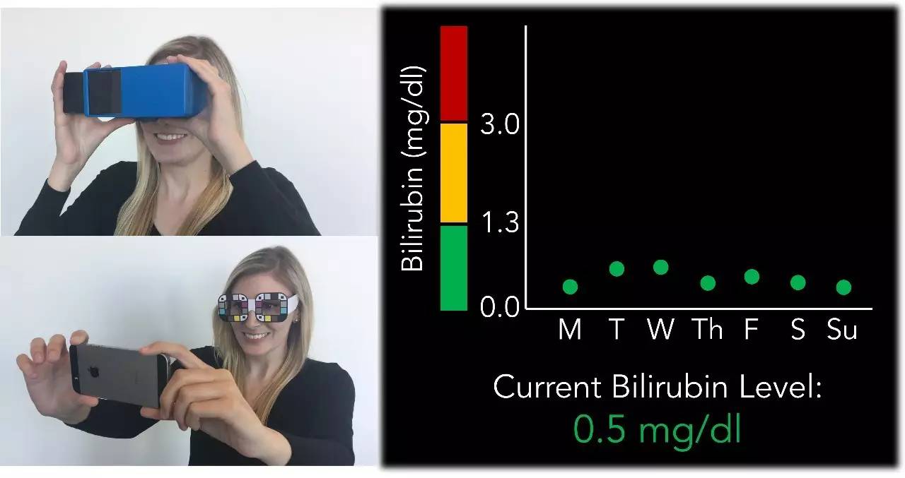新款智能手机APP:用自拍筛查胰腺癌!