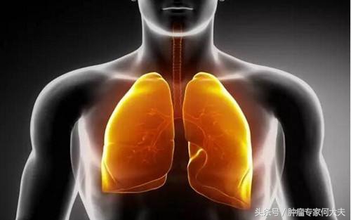 肺癌骨转移活了10年,肺癌脑转移骨转移活了10年