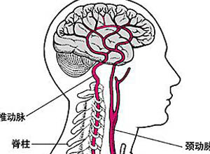 颈椎病为什么会引起头晕头痛恶心,颈椎会引起头疼打嗝吗