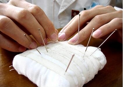 针灸注意事项和禁忌,这些人一定别针灸!