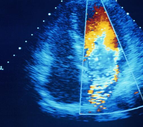 怀孕5个月胎动都是在下腹处,怀孕5个月胎心正常感觉不到胎动