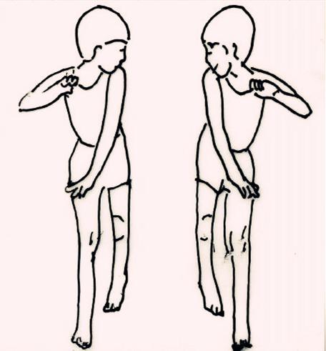 文献《中国脑性瘫痪康复指南（2015）》之神经易化康复技术