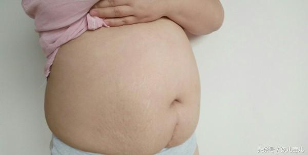 八斤以上的婴儿顺产还是剖腹,头胎剖腹横刀口为啥二胎要竖刀口