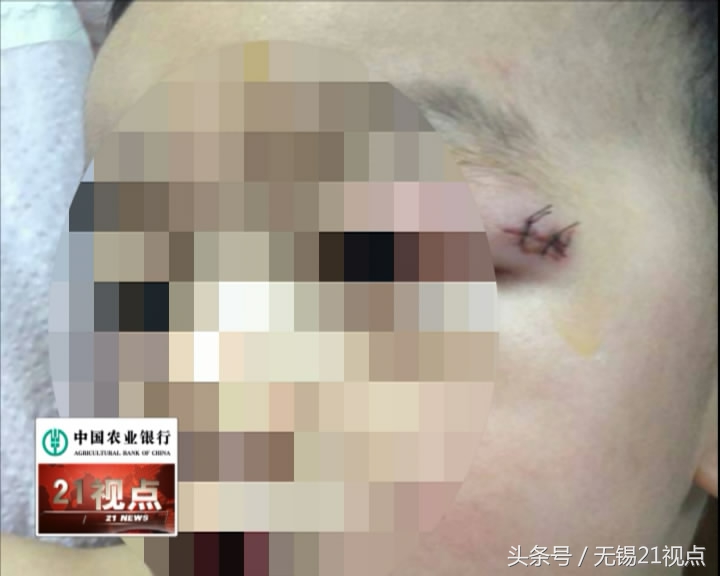 金宝贝早教中心摔倒,早教小孩受伤不去学校怎么处理