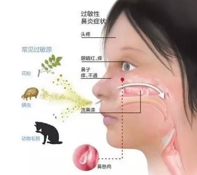 治常年过敏性鼻炎国内前十名医院,北京治疗过敏性鼻炎哪家医院好