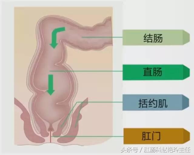 肛瘘是怎么回事?肛瘘是由什么原因造成的