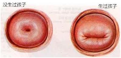 女人生没生过孩子看哪里,女人生没生过孩子去哪里鉴定