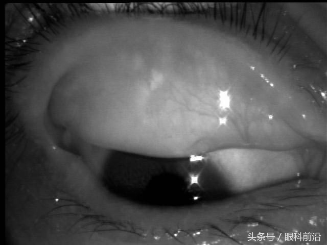 厦门眼健康中心,厦门眼科中心科普馆