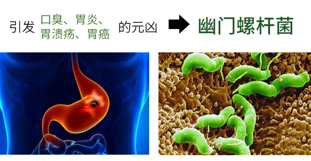 口臭是因为感染了幽门螺旋杆菌吗,口臭就一定是幽门螺旋杆菌感染吗