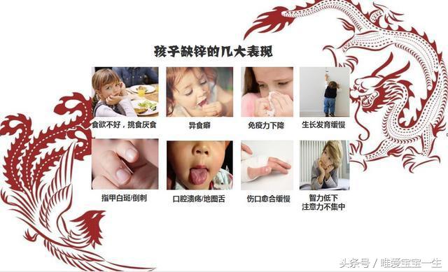 宝宝缺锌需要做哪些检查,一岁三个月宝宝缺锌自测表