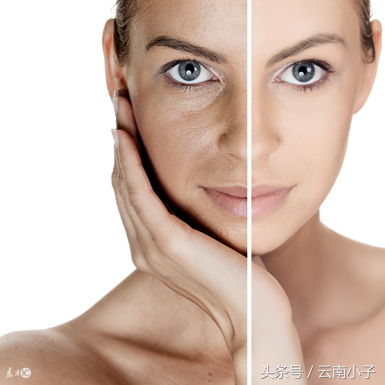 我吃三七粉,主要降低三高,怎么脸上的雀斑全没了!